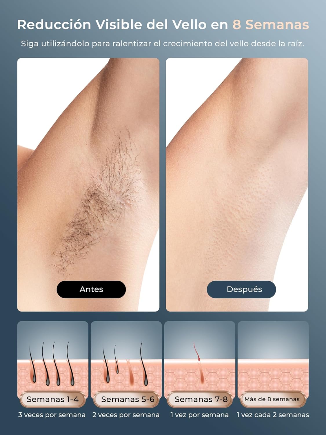Imagen de 21J Depiladora Laser con Función de Refrigeración, 600-1200NM Depiladora Luz Pulsada con 9 Niveles de Energía, Pantalla Táctil LCD para Mujer y Hombre, Bikini, Axilas, Cara, Cuerpo Blanco