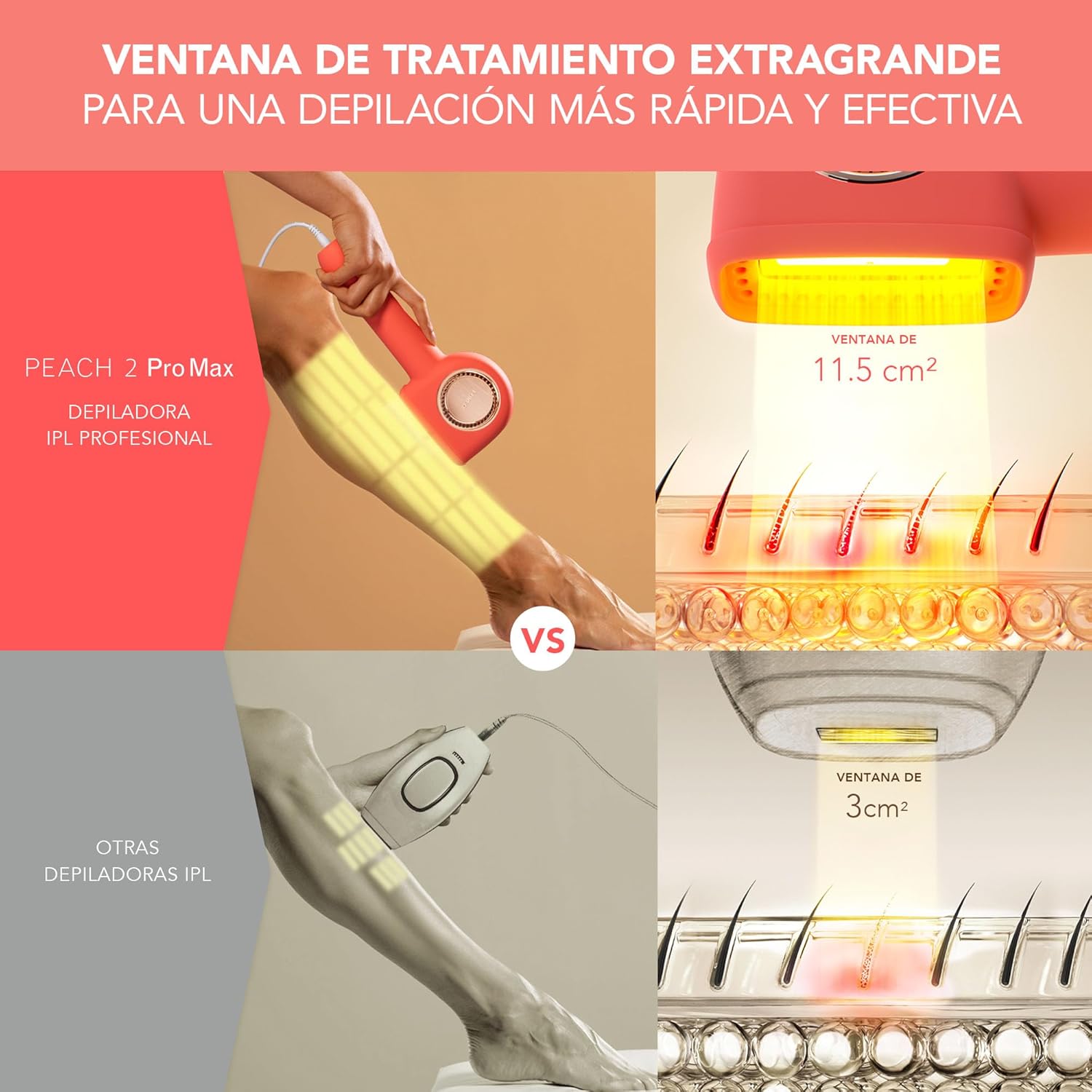 Imagen de FOREO PEACH 2 Pro Max IPL depiladora laser – Depiladora facial mujer y hombre – Para rostro y cuerpo, elimina el vello en hombres & mujeres – Belleza & cuidado personal