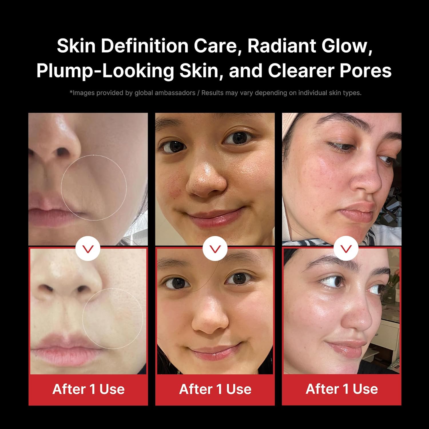 Imagen de medicube AGE-R Booster Pro | Dispositivo de Belleza 6 en 1 para Glass Skin | Para Luminosidad, Elasticidad y Cuidado de la Piel | Skincare Coreano