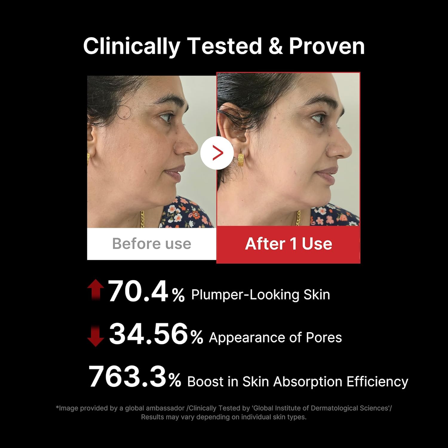 Imagen de medicube AGE-R Booster Pro | Dispositivo de Belleza 6 en 1 para Glass Skin | Para Luminosidad, Elasticidad y Cuidado de la Piel | Skincare Coreano